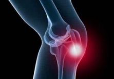Боль над коленной чашечкой