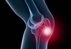 Боль над коленной чашечкой