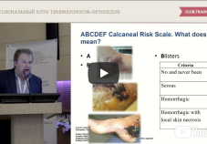 Видео презентация: переломы пяточной кости. Докладчик А.А. Волна (Москва)