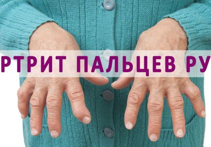 Чем эффективно лечить артрит кистей рук?