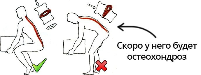Правильное и неправильное поднятие тяжести Причина остеохондроза