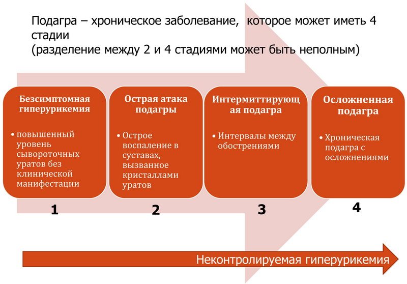 Стадии подагры Стадии подагры