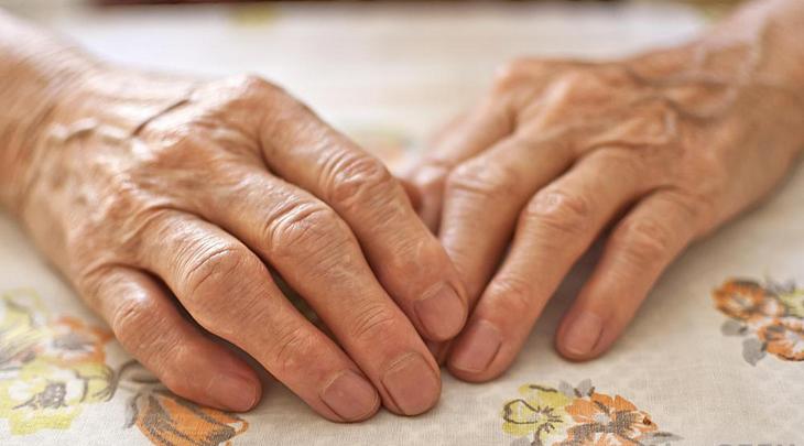 Артроз мелких суставов кистей рук Артроз кистей рук