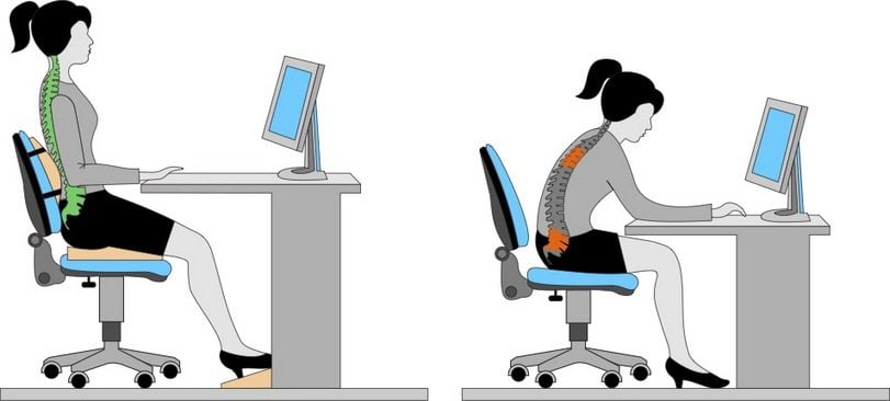 Неправильная осанка 