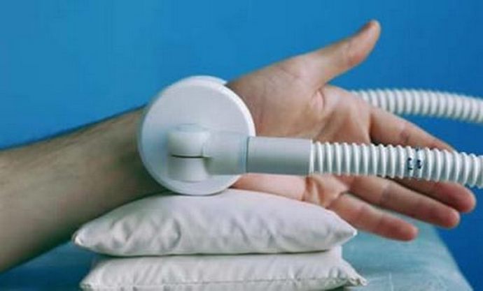 Физиотерапия при гигроме запястья Физиотерапия при гигроме