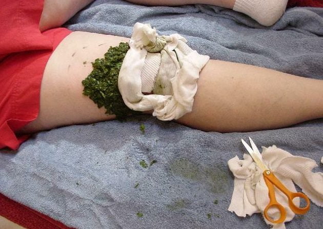 Домашнее лечение колена с помощью компресса Лечение колена дома