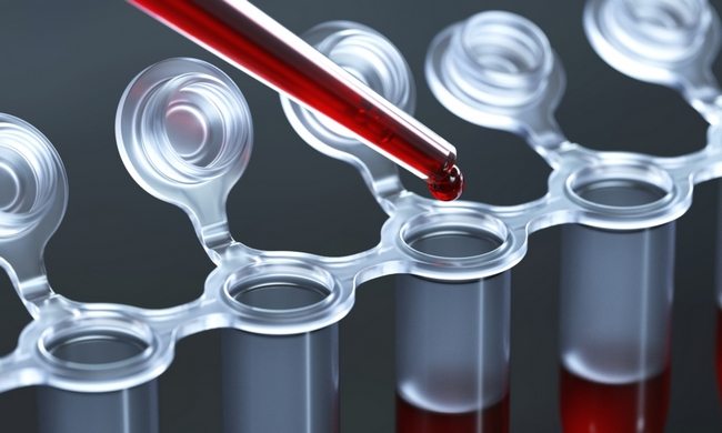 Кровь в пробирках для анализов Кровь в пробирках