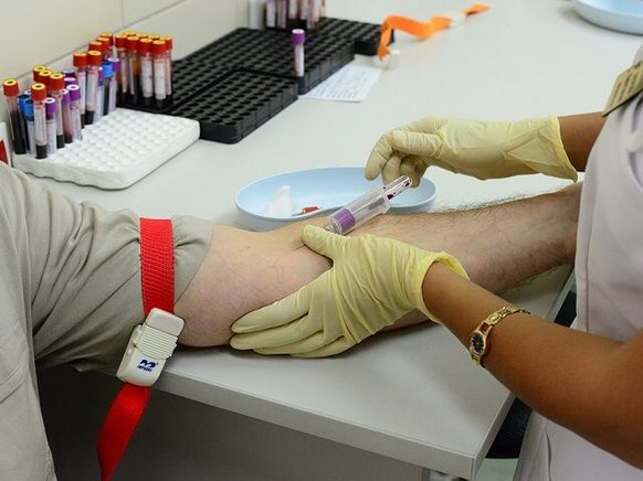 Сбор крови из вены для анализа АЦЦП Сбор крови из вены