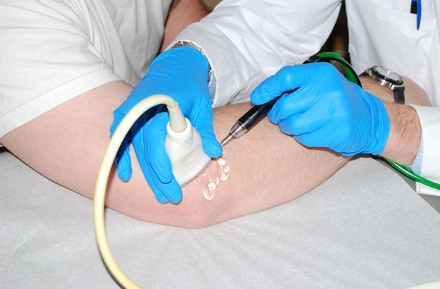 Физиотерапия