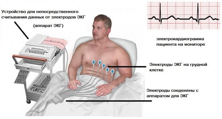 Проведение ЭКГ ЭКГ