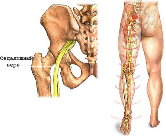 Седалищный нерв у человека Седалищный нерв